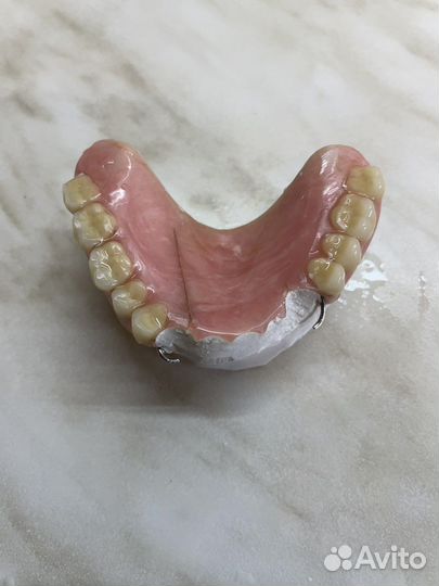 Ремонт акриловых съёмных зубных протезов