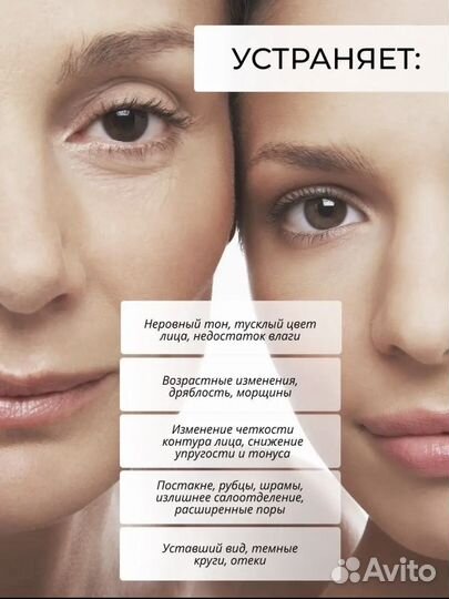 Аппарат для SMAS лифтинга и тд