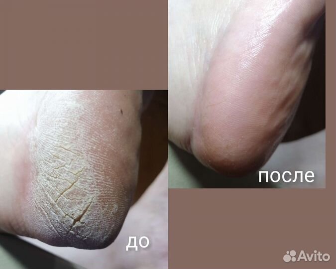 Маникюр, педикюр