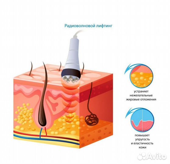 RF лифтинг Кавитация Вакуумный массаж
