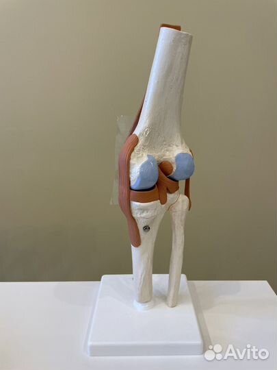 Модель коленного сустава
