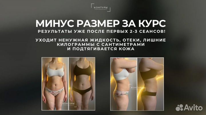 LPG аппаратный массаж