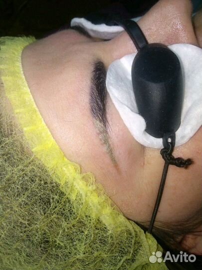 Татуаж, исправление, удаление, комуфляж шрамов