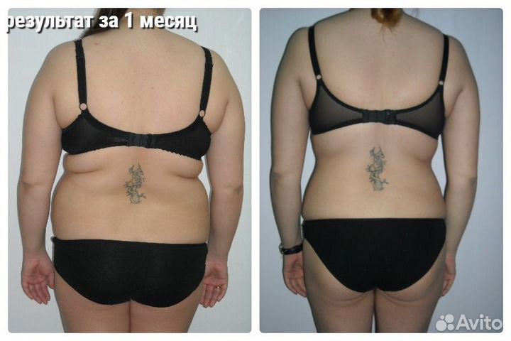 Коррекция фигуры и снижение веса.Похудение.Массаж