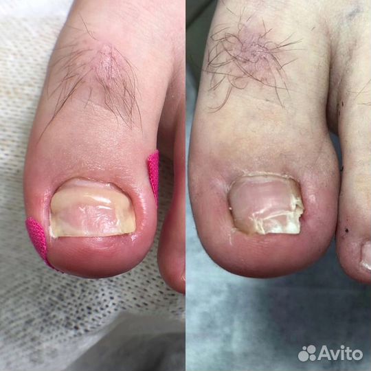 Кабинет педикюра, подолог Лобня