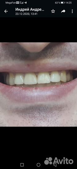 Зубной техник керамист