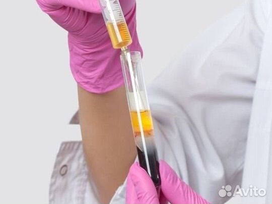 Плазмолифтинг