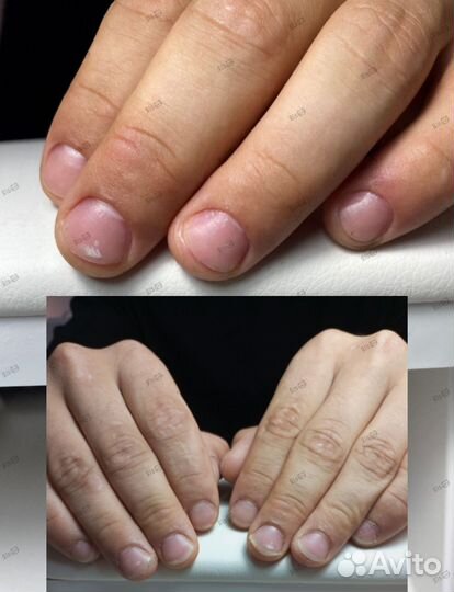 Наращивание ногтей