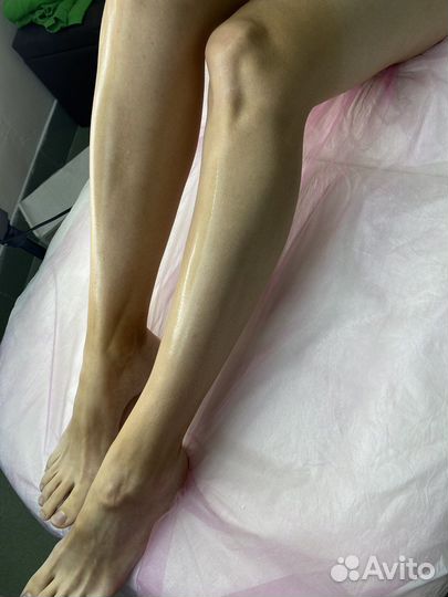 Лазерная эпиляция шугаринг