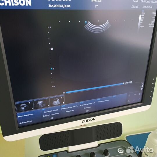 Узи аппарат Chison