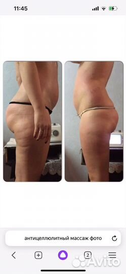 Массаж с выездом на дом(антицеллюлитный, лечебный)