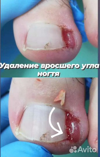 Услуги подолога