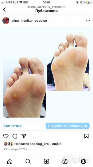 Маникюр/педикюр/подолог