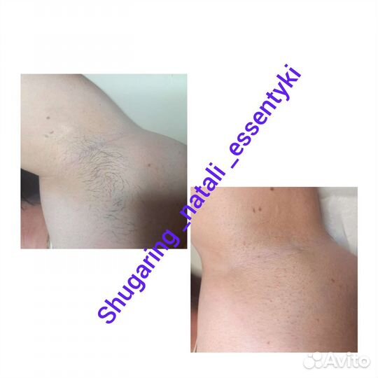 Восковая депиляция