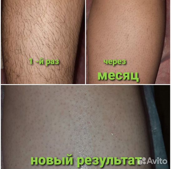 Шугаринг Пенза Арбеково