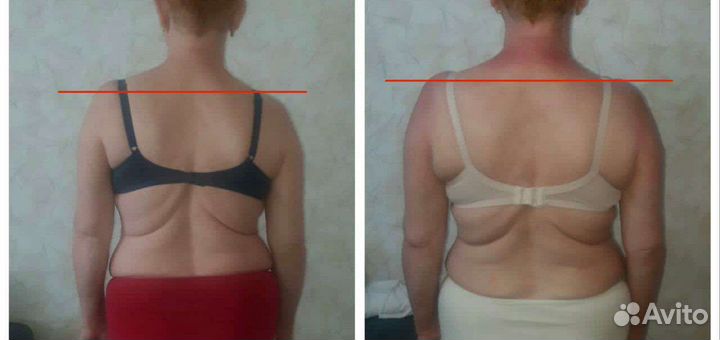 Массаж на дому (диафрагмы тела-тазовое дно)