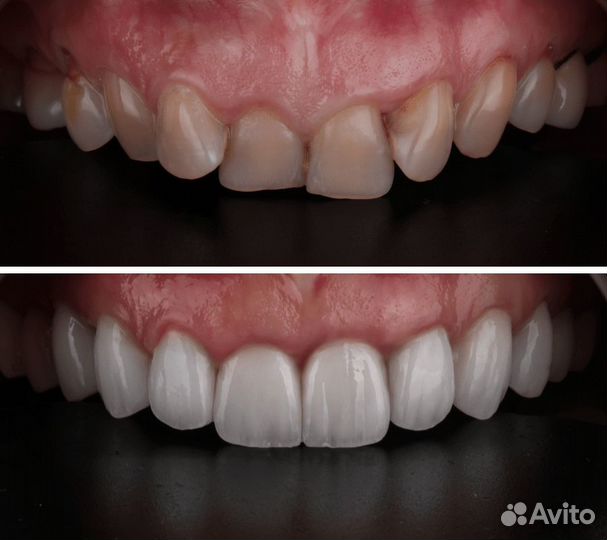 Зуботехническая Лаборатория на Сизова