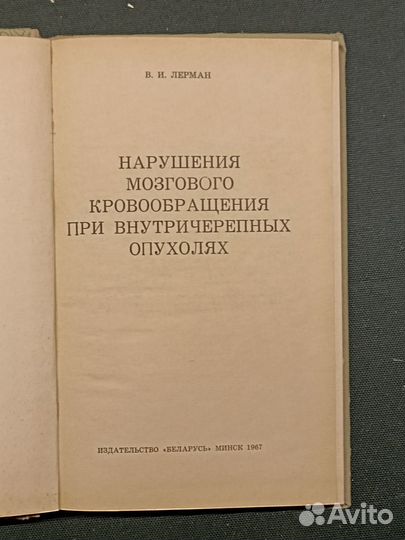 Нарушения мозгового кровообращения при внутричереп