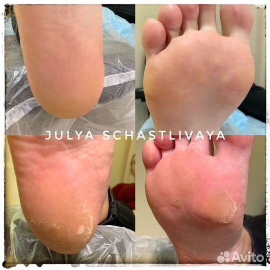 Педикюр smart