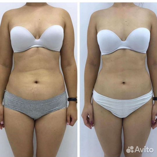 Коррекция фигуры - эффективное похудение