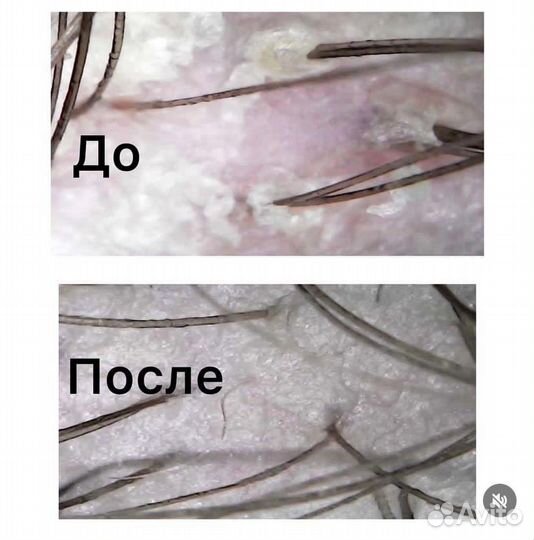 Восстановление волос/ Кератиновое чудо / Davines