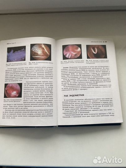 Учебник по гинекологии. Гинекология