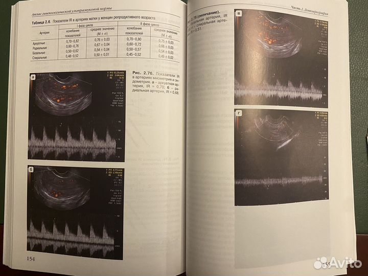 Атлас гинекологич ультразв нормы.Озерская И.А