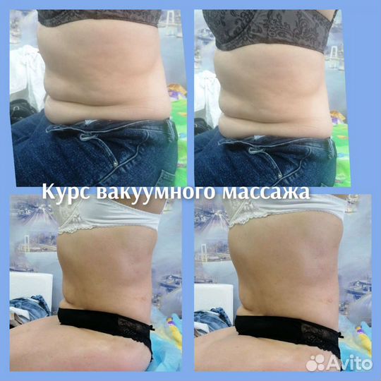 Антицеллюлитный массаж