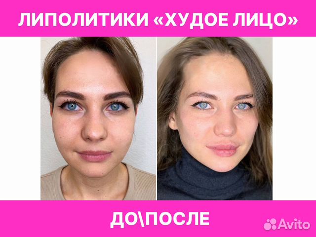 Косметолог, липолитики в Москве | Услуги | Авито