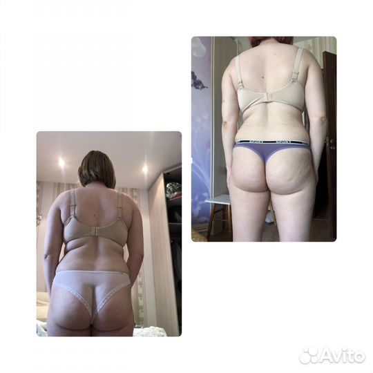 Коррекция Фигуры lpg, кавитация, криолиполиз