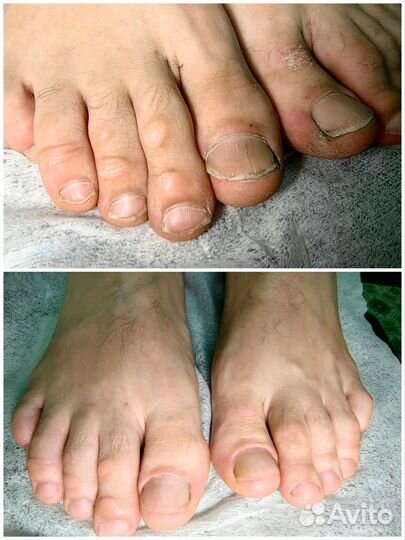 Модель маникюр/педикюр подология