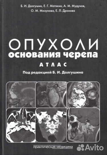 Компьютерная и магнитно-резонансная томография