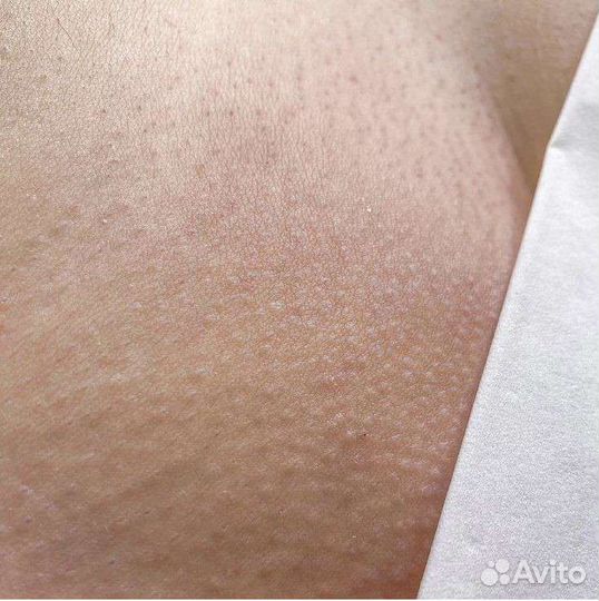 Мужской Шугаринг/Женский шугаринг