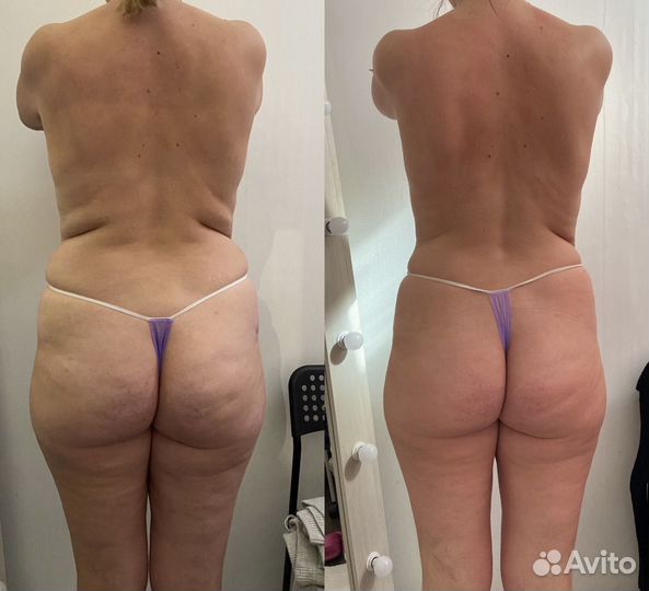 Массаж тела и лица