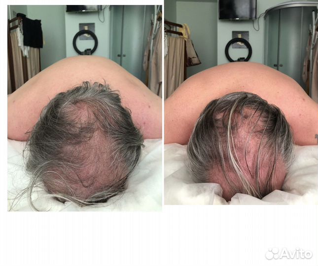 Биоэнергетический массаж