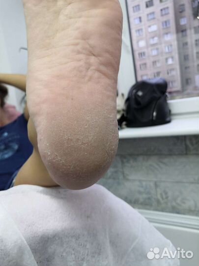 Педикюр для мужчин