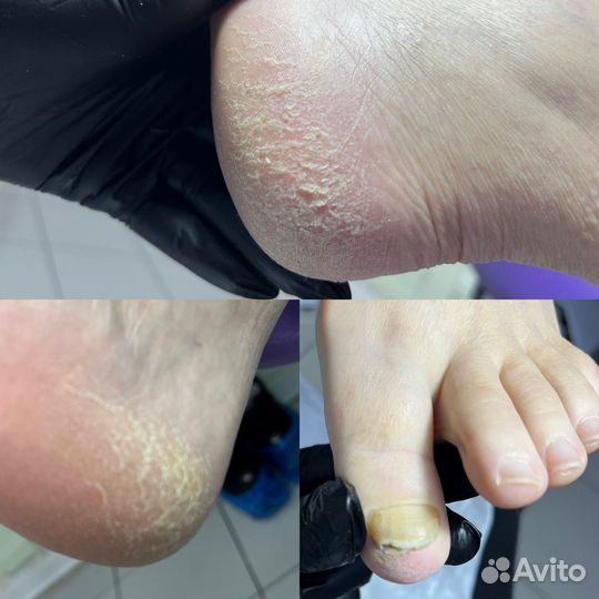 Педикюр (не.мед подолог)