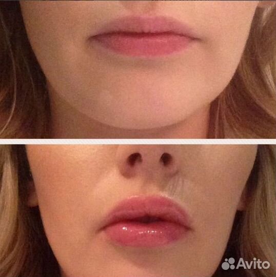 Модели на губы