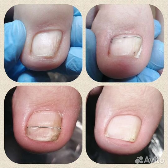 Педикюр, подология и эстетика