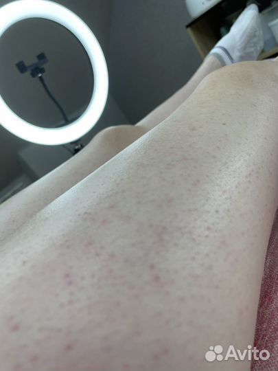 Шугаринг, депиляция, лазерная эпиляция