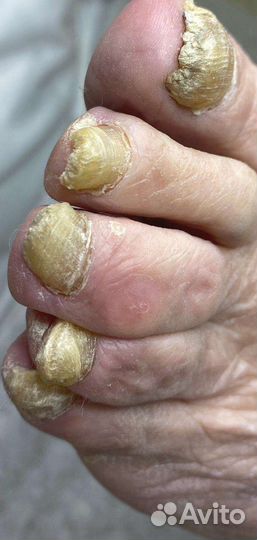 Педикюр,маникюр,подология,выезд на дом