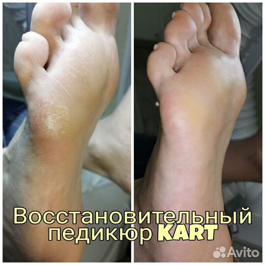 Маникюр, педикюр