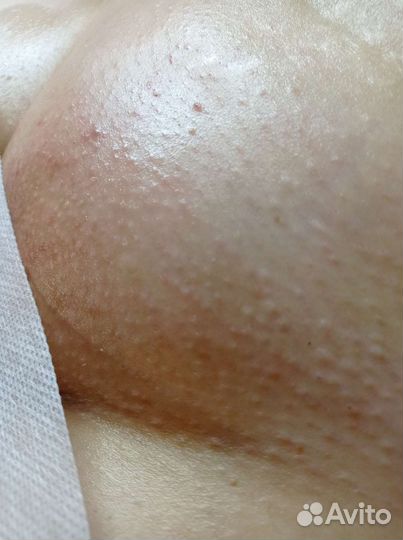 Шугаринг женский