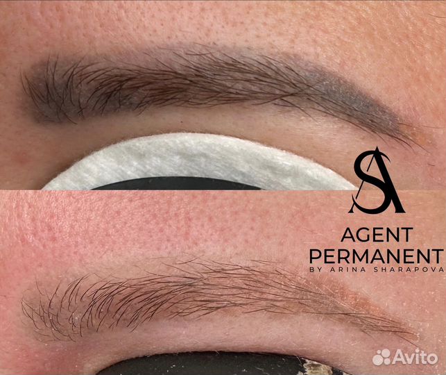 Удаление татуажа перманетного макияжа