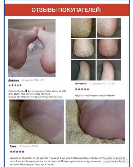 Средство для удаления ороговевшей кожи