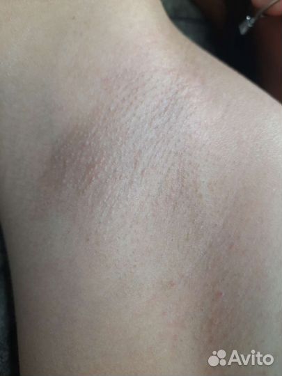 Депиляция воском,шугаринг