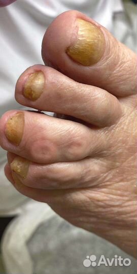 Педикюр,маникюр,подология,выезд на дом