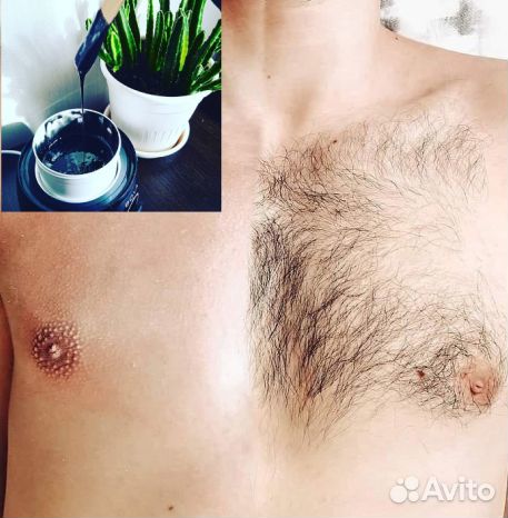 Шунгитовый шугаринг