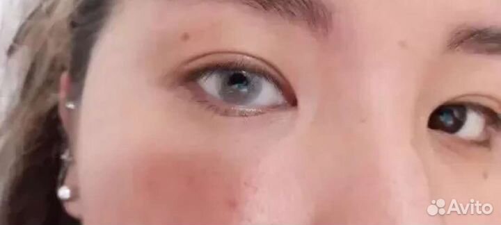 Линзы натуральные, Контейнеры