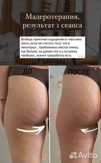 Массаж на дому 5 просека/массаж лица